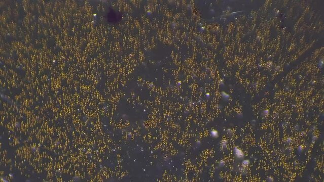 Blood of human smear filmed with oblique illumination under microscope 100x. Lymphocyte and eosinophil in macro footage under cross light. Hematology laboratory investigation. Organism functions
