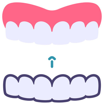 Invisalign Teeth