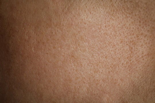 Texture of human skin as background, closeup view