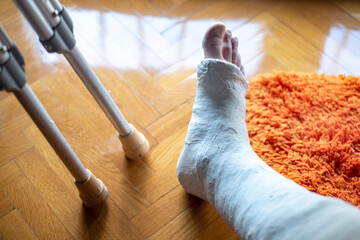 long leg plaster cast, patient view
