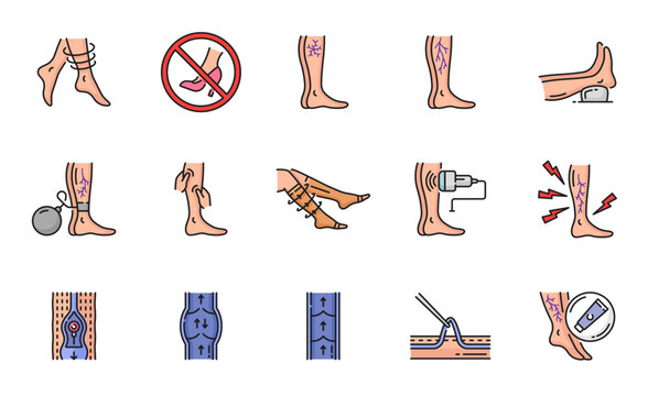 Varicose treatment icons, leg veins disease and thrombosis surgery, vector line symbols. Varicose or vascular varices circulation insufficiency, medical treatment, compression therapy and prophylactic