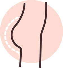 Gluteoplasty surgery, illustration, vector on white background.
