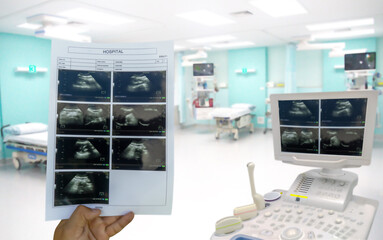 Surface blur View doctor checking ultrasound and bed Of Empty Emergency Room background,view of a couple of empty beds in an emergency room at a hospital