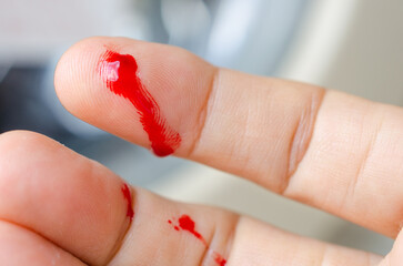 Cut wounds
