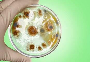 Hand hold Petri dish with bacteria germs