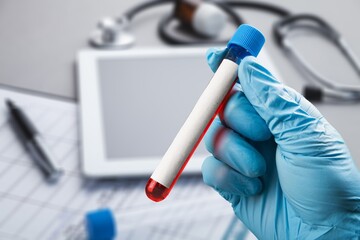 Medical sample for blood test in laboratory