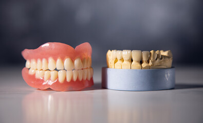 Dentist teeth and gums model