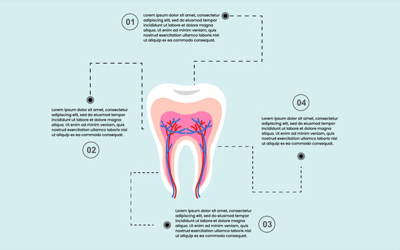 Anatomy and tooth structure, cavity. infographic template with four options.