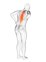 3d rendered medically accurate illustration of a man having acute back pain