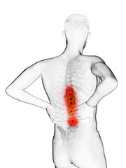 3d rendered medically accurate illustration of a man having a backache