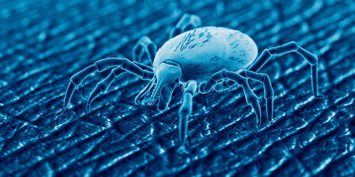 3d Rendered Illustration Of A Tick On Human Skin, Sem Style