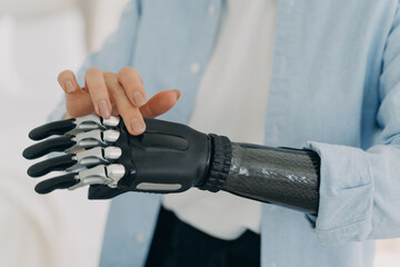 Disabled female touches high tech artificial arm limb, close up. Bionic hand prosthesis advertising