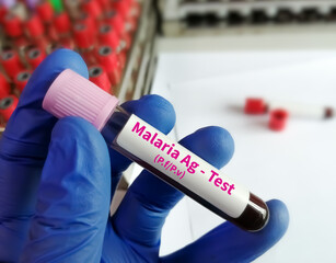 Researcher holding blood sample for malaria antigen test.