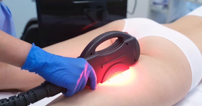 Elos laser hair removal of legs in beauty salon closeup