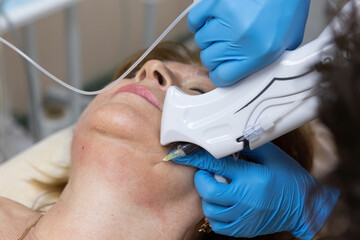 Correction of the second chin by injections of carbon dioxide by a cosmetologist woman aged