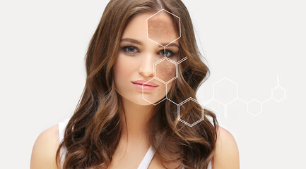 Dark spots, freckles,hyperpigmentation(melasma or chloasma),concept - skin lightening, skin whitening, fruit acids,AHA, Skin Brightening