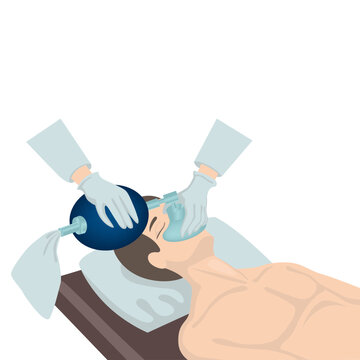 Artificial ventilation of the lungs using an ambu bag. Vector flat illustration