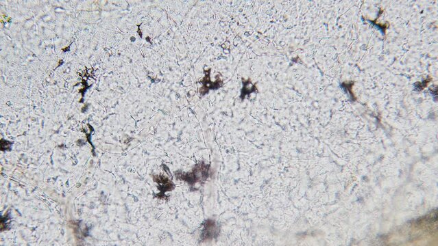 Blood erythrocyte movement in blood vessels capillaries pigment cells microscopy in tadpole tail