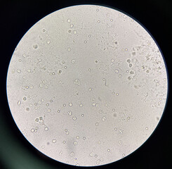 Moderate bacteria in urine sample.