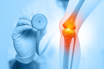 Orthopaedics doctors examining human knee joints. Osteoarthritis, rheumatoid arthritis, joint disease. Knee Joint and bone treatment. 3d illustration - obrazy, fototapety, plakaty