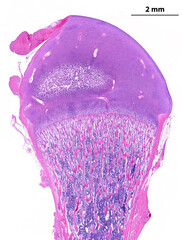 Epiphysis. Secondary ossification centre