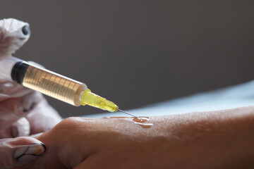Doctor doing stem cell therapy on a patient's elbow after the injury. Treating knee pain with...