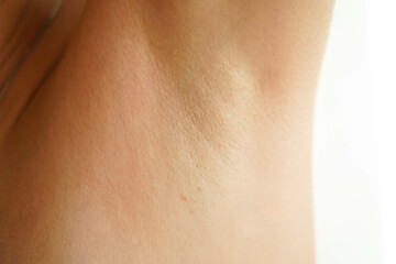 Women's armpit close-up. Thin and sparse hair on a female armpit. The result after completing an incomplete course of laser hair removal.
