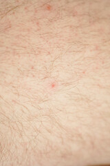 Fototapeta premium Close-up of hairy skin. Hair on a man's leg