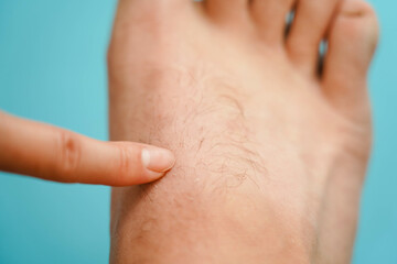 Close-up of hairy skin. The index finger points to the hair on the man's leg.