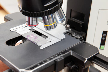 Closeup of a microscope slide with stained tissue biopsy under the microscope. Cancer diagnosis...