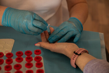 donor's day. a nurse in blue latex gloves takes a blood sample from a patient. medical blood jars....