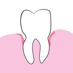 Tooth and gum pattern with rejection and gum inflammation