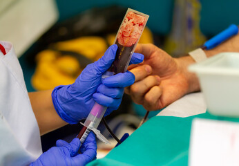 Nurse obtains blood sample for analysis during a blood donation