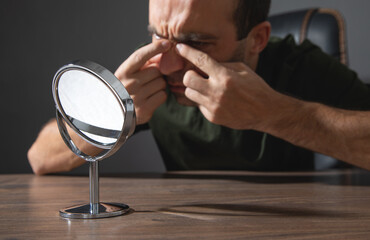  Man trying squeeze acne on face.