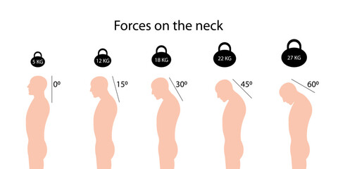 Forces on the neck. Angles and weights. Improper posture symptoms. Spinal curvature - obrazy, fototapety, plakaty