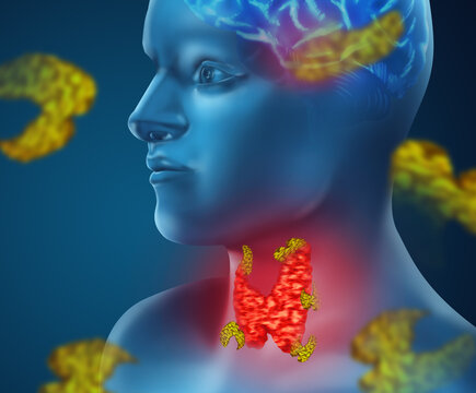 Illustration of human with inflamed thyroid gland on color background