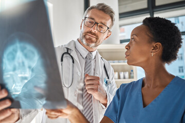 Brain, x ray and neurology doctors in a meeting working on a skull injury in emergency room in a hospital. Diversity, cancer and healthcare medical neurologist checking mri or xray scan with teamwork - obrazy, fototapety, plakaty