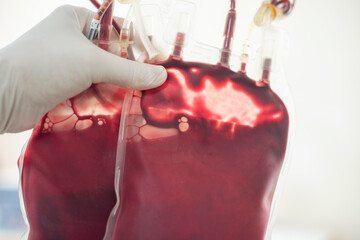 Blood bag in hand scientis.