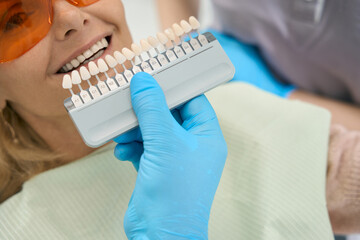 Dentist is choosing color of new whitening vinyl teeth in the dental office