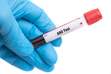 ASO Test Medical check up test tube with biological sample - obrazy, fototapety, plakaty