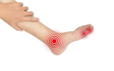 Multiple foot joints inflammation. Concept of rheumatoid arthritis, polyarthritis, gout, toe joint...