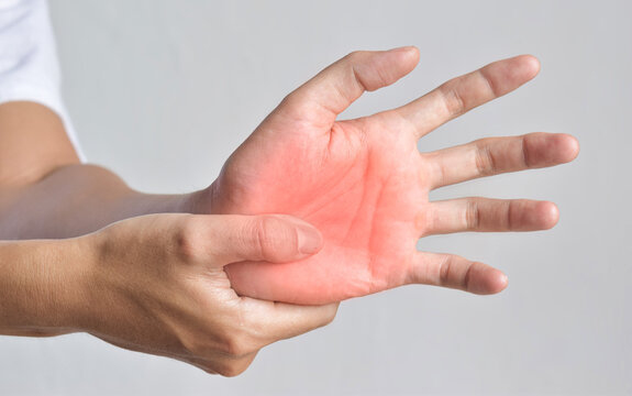 Painful Palm Of Asian Man. Concept Of Compartment Syndrome, Cellulitis And Hand Muscles Pain.