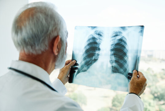 doctor hospital medical medicine health x-ray clinic healthcare radiology care diagnosis xray senior virus