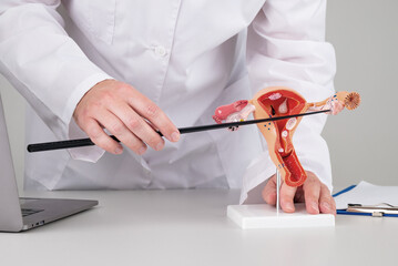 doctor gynecologist pointing model of female reproductive system on his desktop