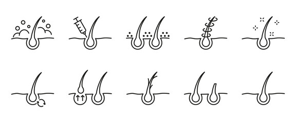 Hair Care and Loss Problem. Hair Cosmetic Line Icons. Shampoo, Dandruff, Haircut, Growth and Alopecia Outline Icon. Treatment and Problem of Hair. Editable Stroke. Isolated Vector illustration - obrazy, fototapety, plakaty