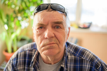 Aged man with facial nerve paralysis, Bell's palsy. - obrazy, fototapety, plakaty