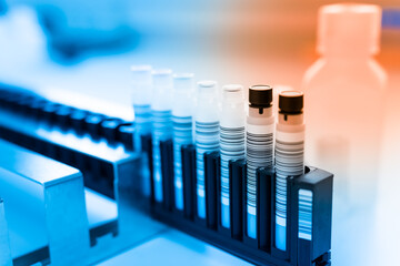 Reagent tubes and bottes for laboratory analysis automate machine.Sample specimen in test tube and chemistry and immunology reagent bottle .Conceptual image COVID-19 test tube sample.