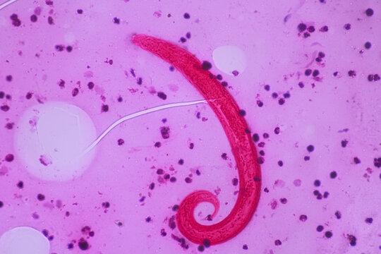 View in microscopic Strongyloides stercoralis or threadworm in human stool.Parasite infection.Medical background analyze by microscope, original magnification 400x
