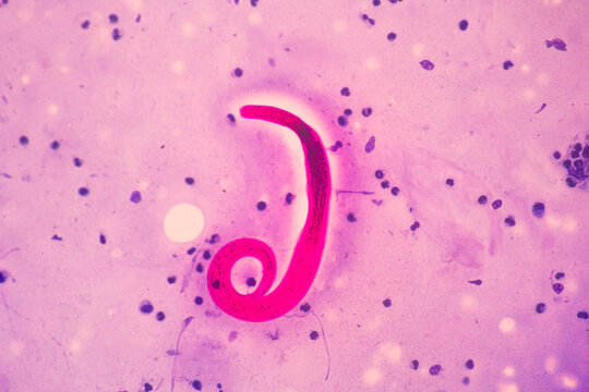 View in microscopic Strongyloides stercoralis or threadworm in human stool.Parasite infection.Medical background analyze by microscope, original magnification 400x