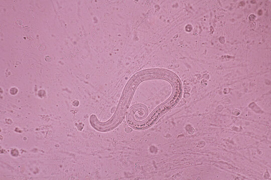 View in microscopic Strongyloides stercoralis or threadworm in human stool.Parasite infection.Medical background analyze by microscope, original magnification 400x